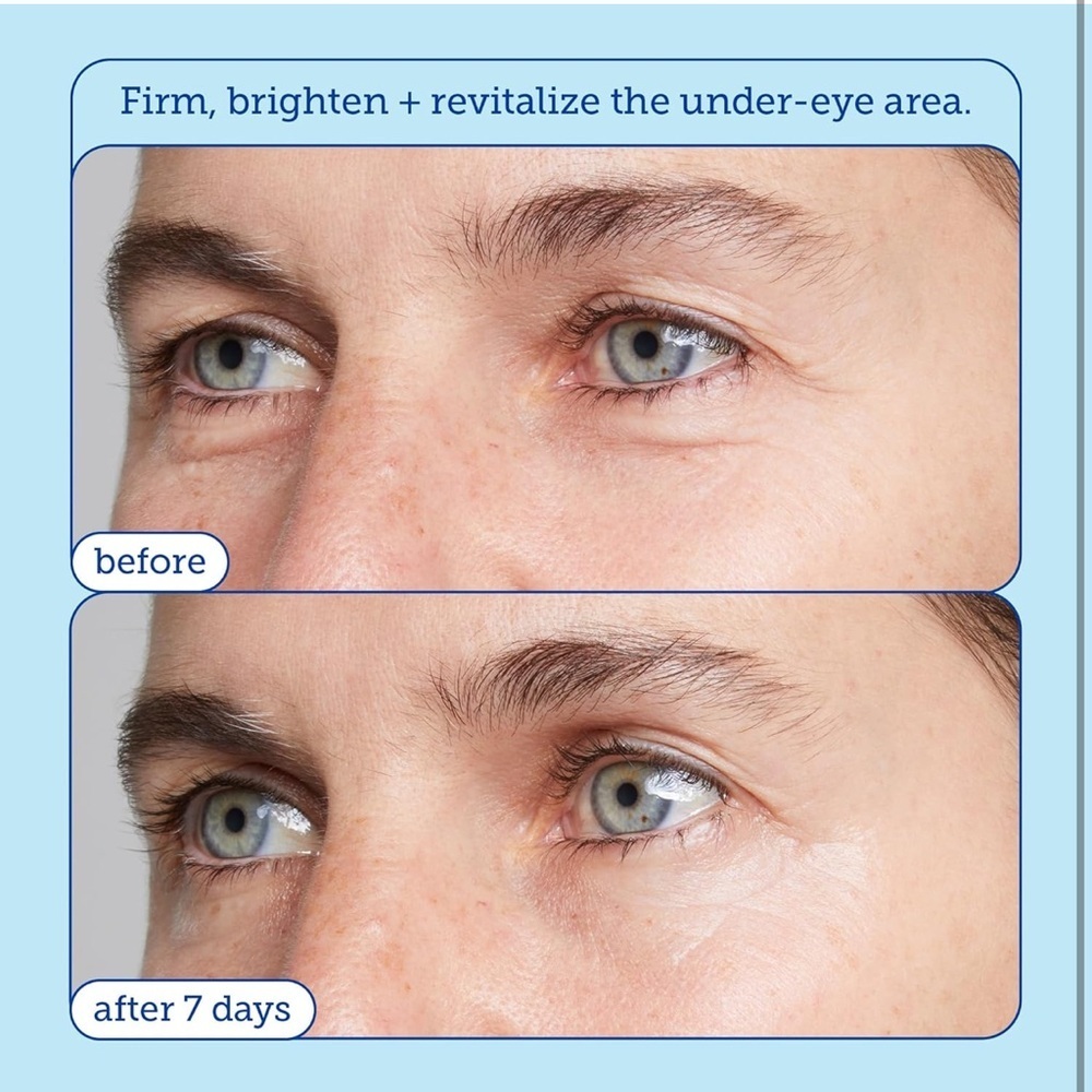 Skinfix Barrier+ Triple Lipid Eye Treatment, 15 ml - Picture 6 of 7